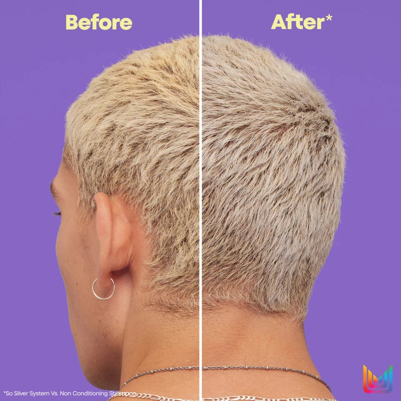 so silver matrix before and after